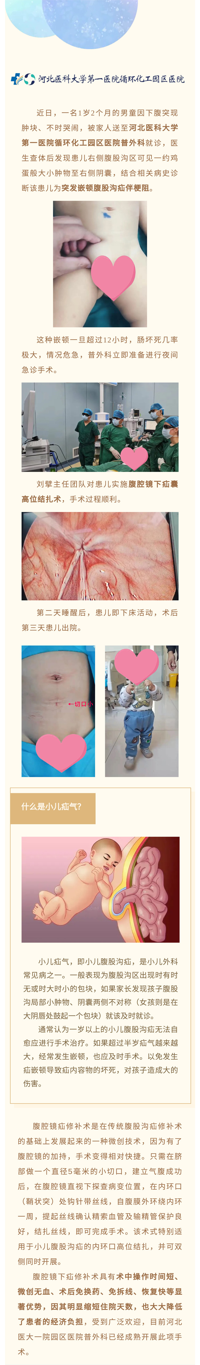 腹腔鏡微創(chuàng)手術(shù)治療小兒疝氣——切口5毫米！手術(shù)→活動，僅半天！-1.jpg